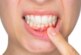 Опасный пародонтит: стоматолог назвала 7 факторов риска для зубов