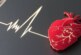 Сибирские хирурги заменили протез клапана сердца пациентки без удаления каркаса прежнего