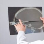По самую рукоятку: в Кабардино-Балкарии хирурги извлекли нож из глаза пациента