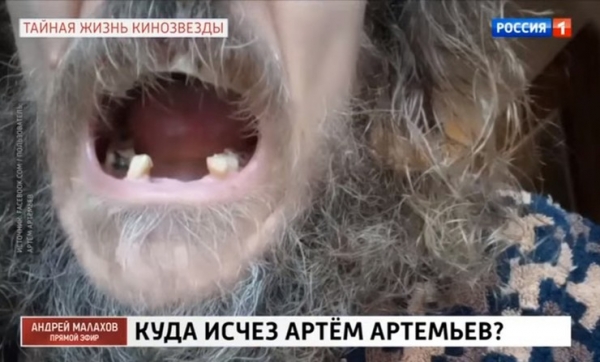 Звезда сериала «Татьянин день» Артем Артемьев: «Меня отравили. Выпали все зубы и волосы» |  Корреспондент