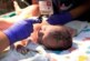 У новорожденных с COVID-19 обнаружили признаки поражения сетчатки