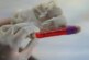 Эксперт предупредил о неминуемом заражении «практически всех» коронавирусом «Омикрон»