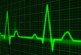 Ученый Сериков связал переработки с риском развития ишемической болезни сердца