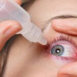 Офтальмолог рассказал о причинах и способах лечения синдрома сухого глаза